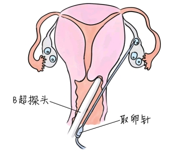 幼儿学画画，昆明捐卵宝宝学画画，学画画的好处，如何学画画